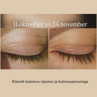 ripsmeseerum dandeelion