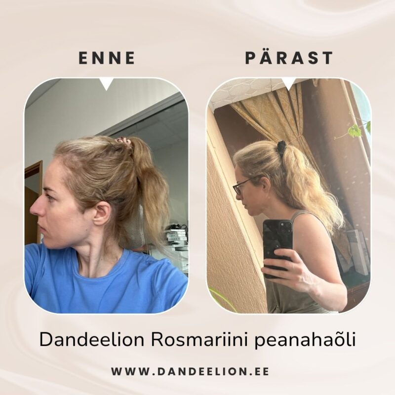 rosmariiniõli juustele